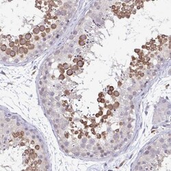 ADAT3 Antibody, Novus Biologicals 25 &mu;L, Unlabeled:Antibodies, Polyclonal